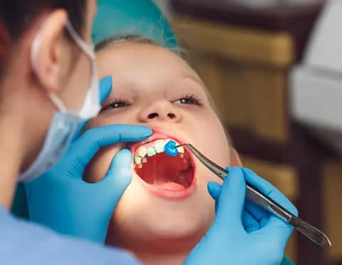 A dentist applies fluoride varnish to a child's teeth